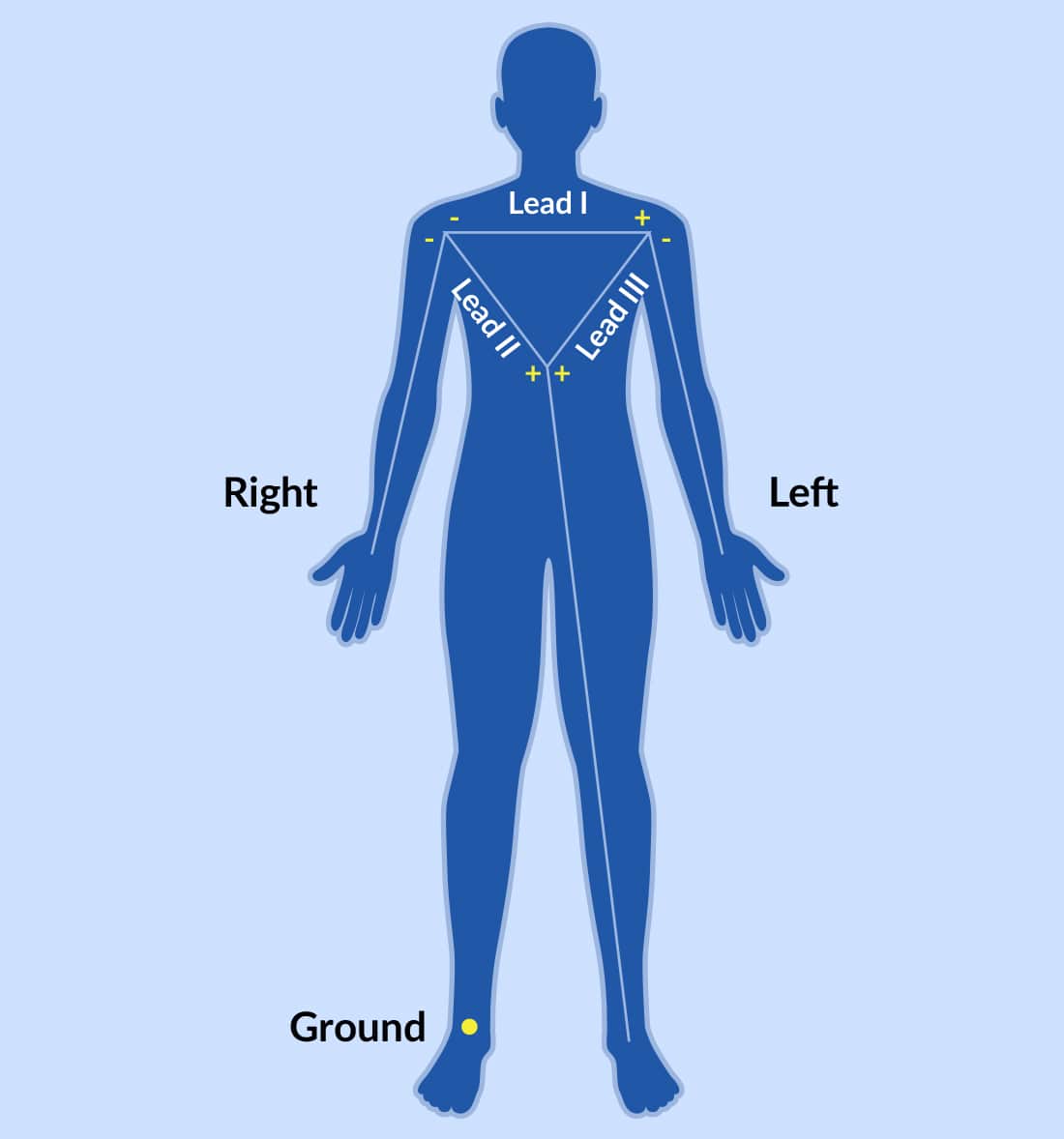 Cardiac Monitoring Devices