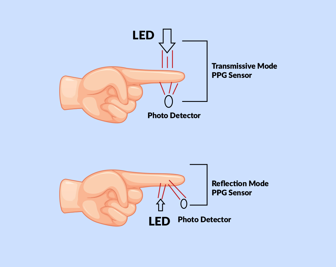 Cardiac Monitoring Devices